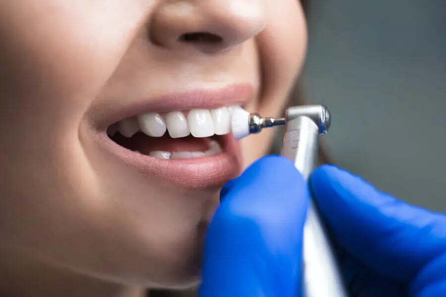 Dental treatment in uttam nagar
